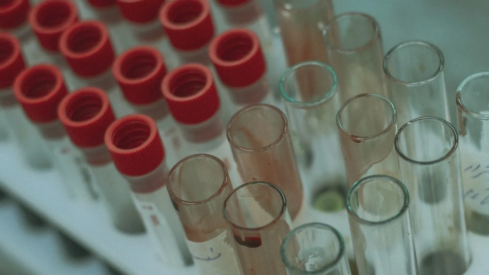 Bloedbuisjes met rode doppen in een rek, klaar voor onderzoek in het laboratorium.