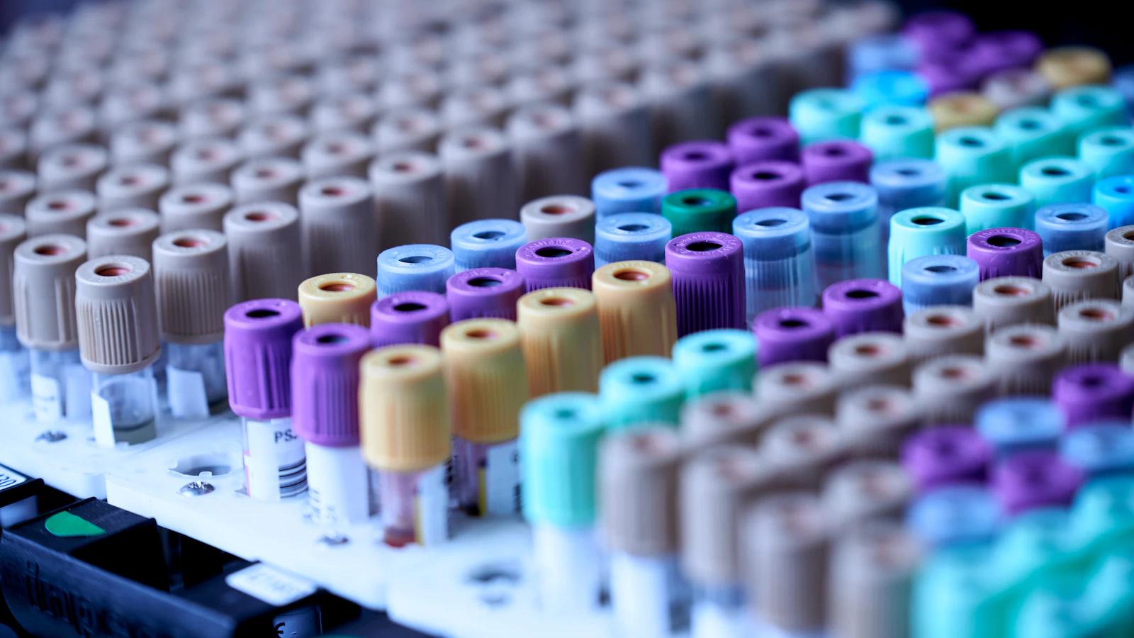 Colour-coded blood collection tubes in a rack in the lab.